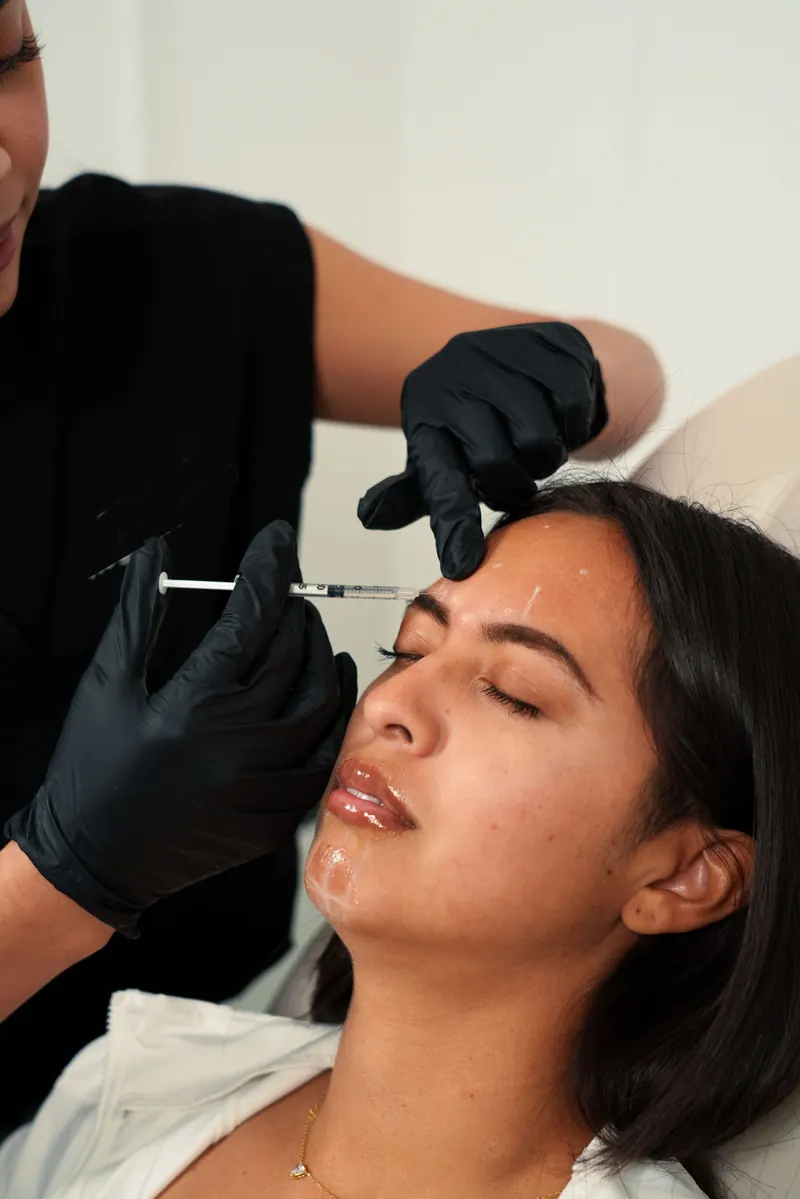 Profissional de luvas pretas aplicando injeção estética na testa de uma paciente